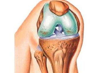 Awọn okunfa akọkọ ti Kneee arthrosis