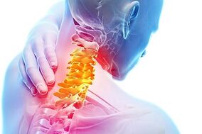 Awọn aami aisan ti osteochondrosis ati awọn ofin ounjẹ fun arun