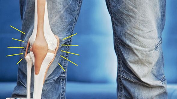 irora ni isẹpo orokun